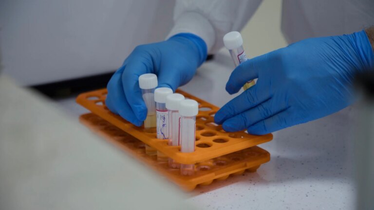 A $435 Million Bet on ‘Reversing Aging’